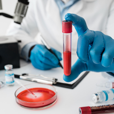blood-test